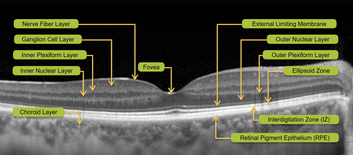 Retina